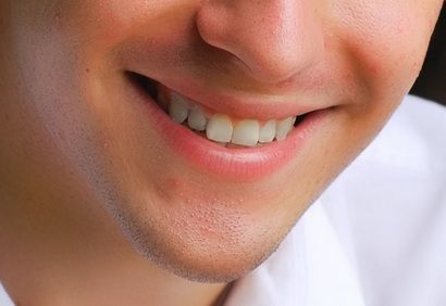 curso de est�tica do tratamento periodontal...