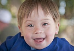 Como lidar com crianças com síndrome de Down?