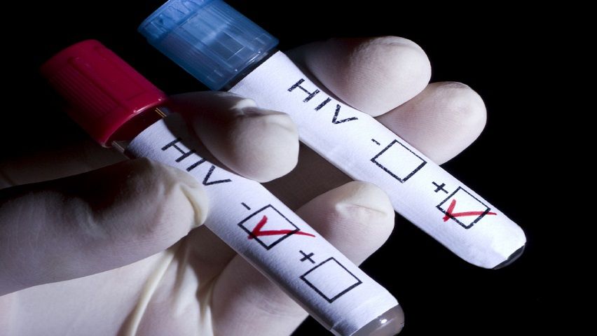 Cours sur les soins infirmiers pour le patient atteint du VIH